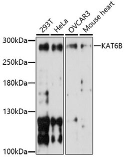 Folliculin Rabbit anti-Human, Mouse, Rat, Polyclonal, Novus Biologicals:Antibodies:Primary